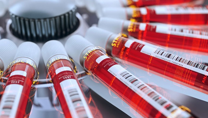 การประยุกต์ใช้การหมุนเหวี่ยงในอุตสาหกรรมยา